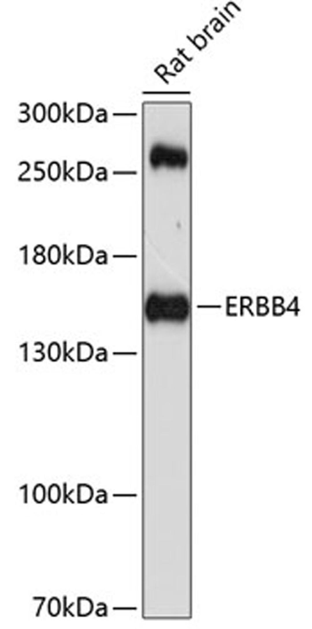 Western blot - ERBB4 antibody (A0749)