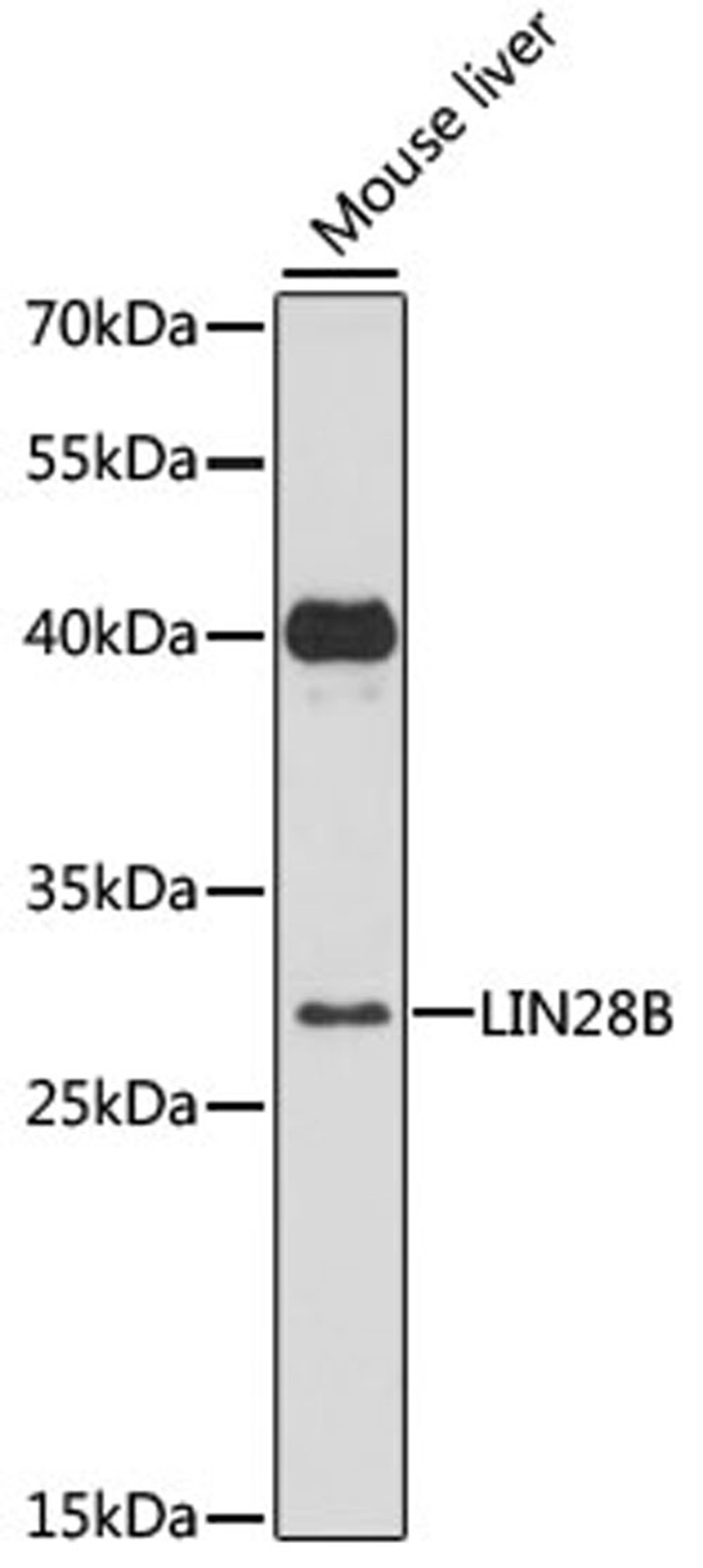 Western blot - LIN28B antibody (A12957)