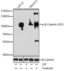 Western blot - Phospho-beta Catenin-S552 antibody (AP0579)