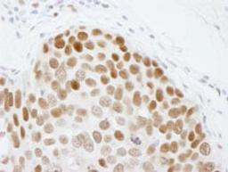 Detection of human CBX3 by immunohistochemistry.