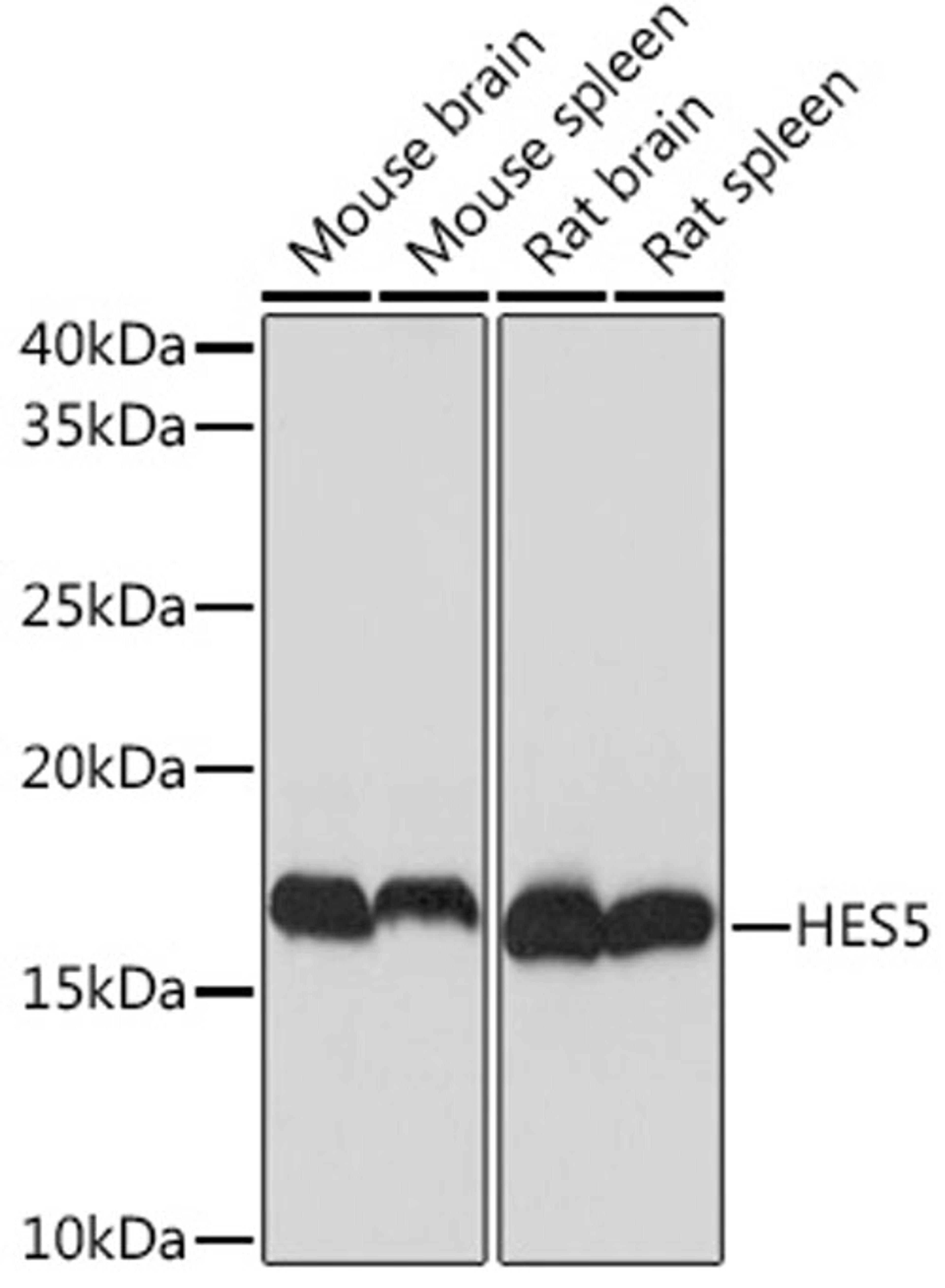 Western blot - HES5 Rabbit mAb (A9768)