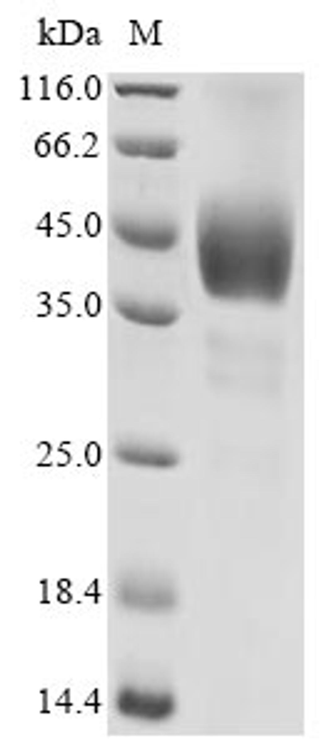 (Tris-Glycine gel) Discontinuous SDS-PAGE (reduced) with 5% enrichment gel and 15% separation gel.