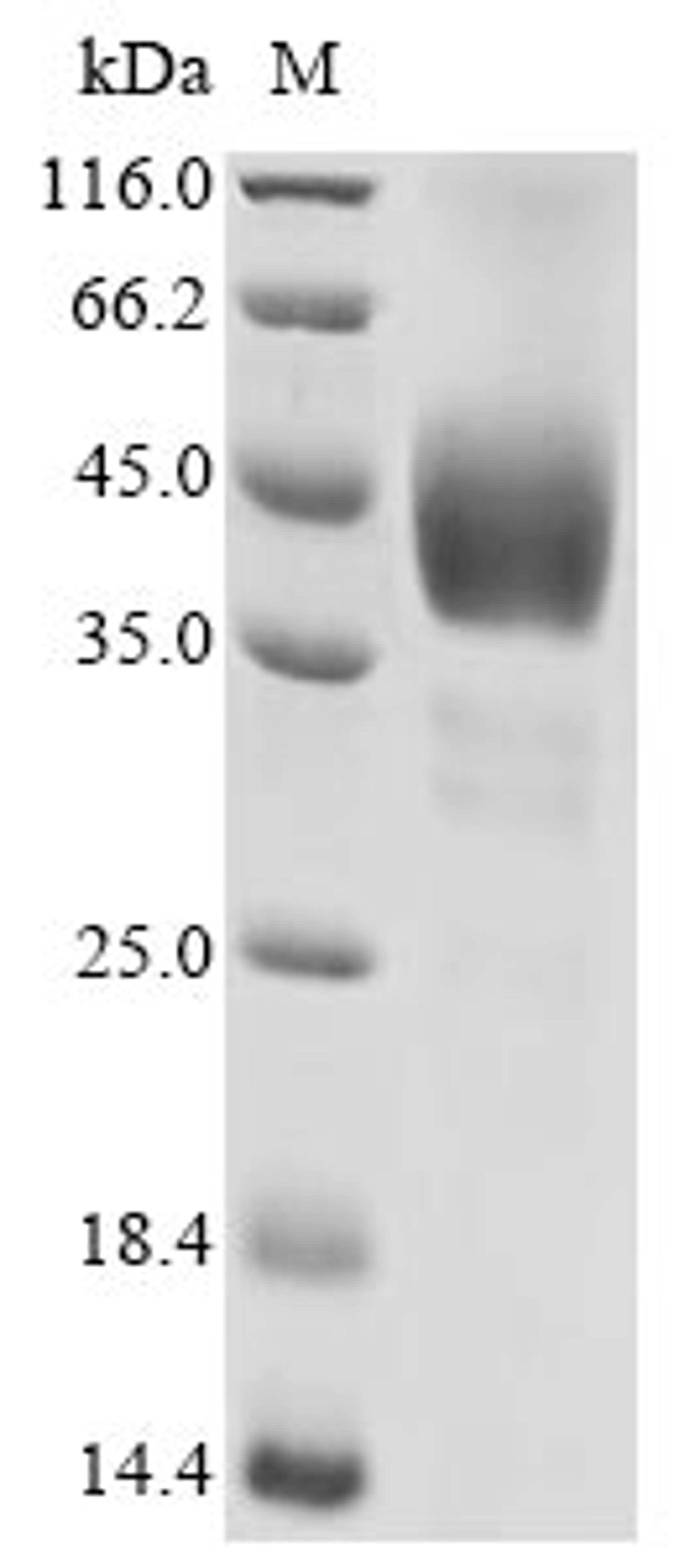 (Tris-Glycine gel) Discontinuous SDS-PAGE (reduced) with 5% enrichment gel and 15% separation gel.