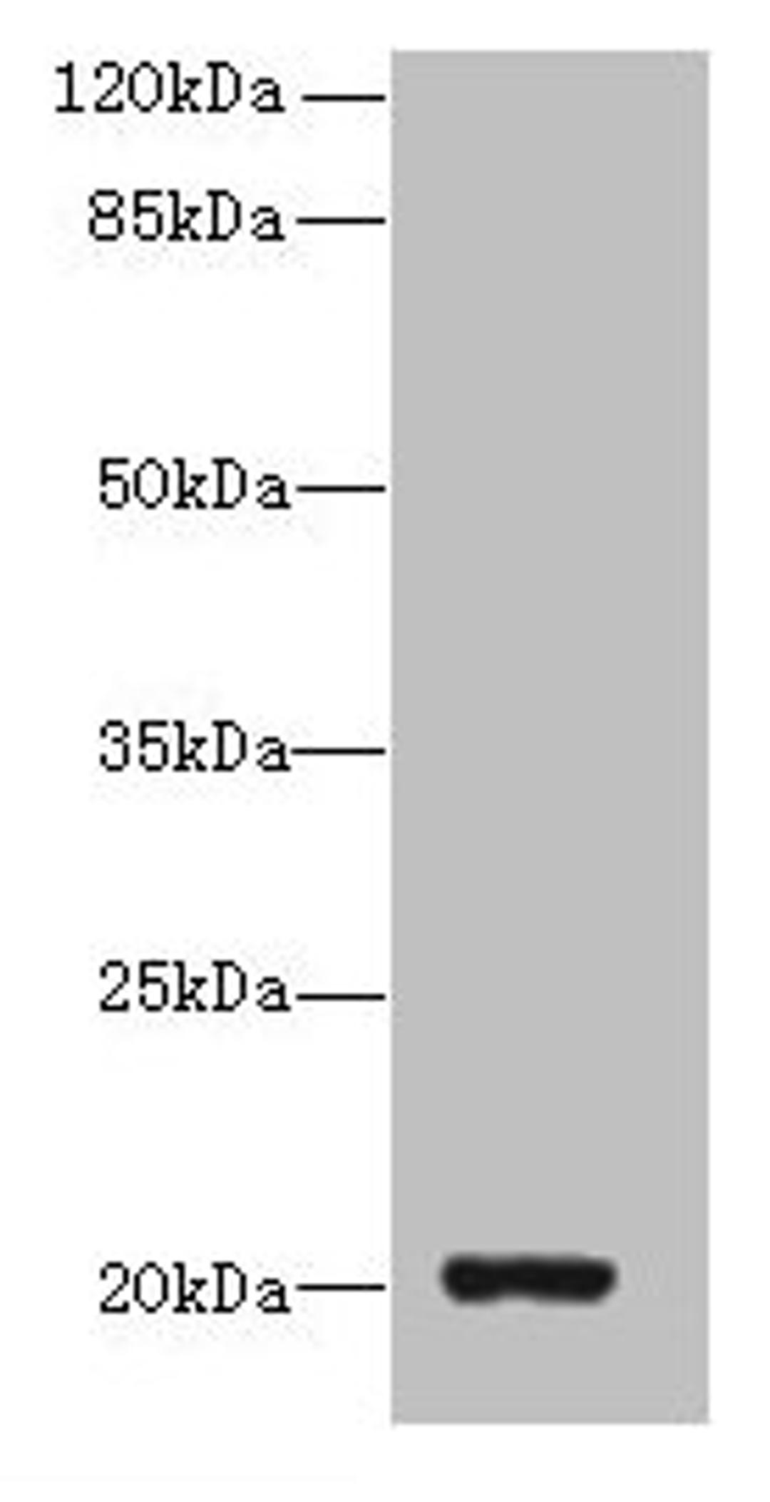 Western blot. All lanes: ZBTB8OS antibody at 8µg/ml + HL60 whole cell lysate. Secondary. Goat polyclonal to rabbit IgG at 1/10000 dilution. Predicted band size: 20, 16 kDa. Observed band size: 20 kDa