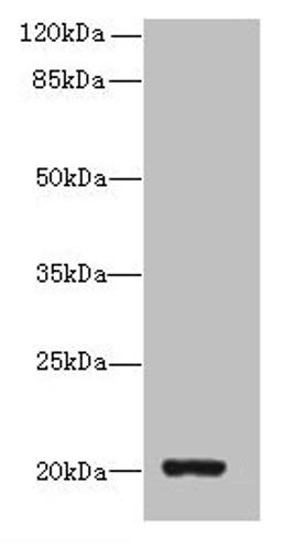 Western blot. All lanes: ZBTB8OS antibody at 8µg/ml + HL60 whole cell lysate. Secondary. Goat polyclonal to rabbit IgG at 1/10000 dilution. Predicted band size: 20, 16 kDa. Observed band size: 20 kDa