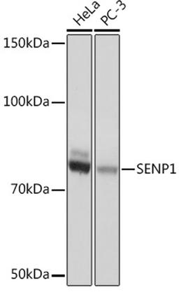 Western blot - SENP1 Rabbit mAb (A4460)