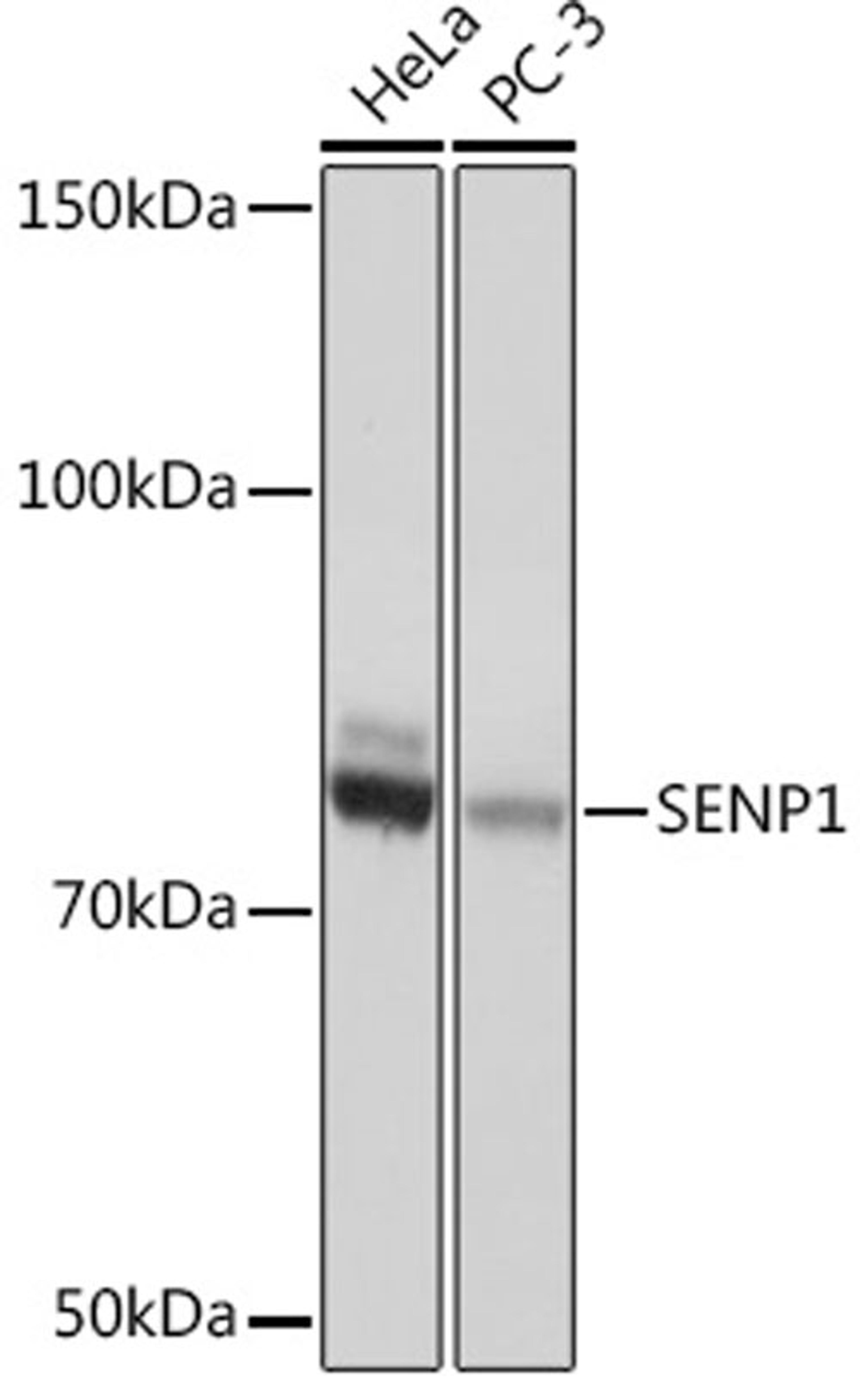 Western blot - SENP1 Rabbit mAb (A4460)