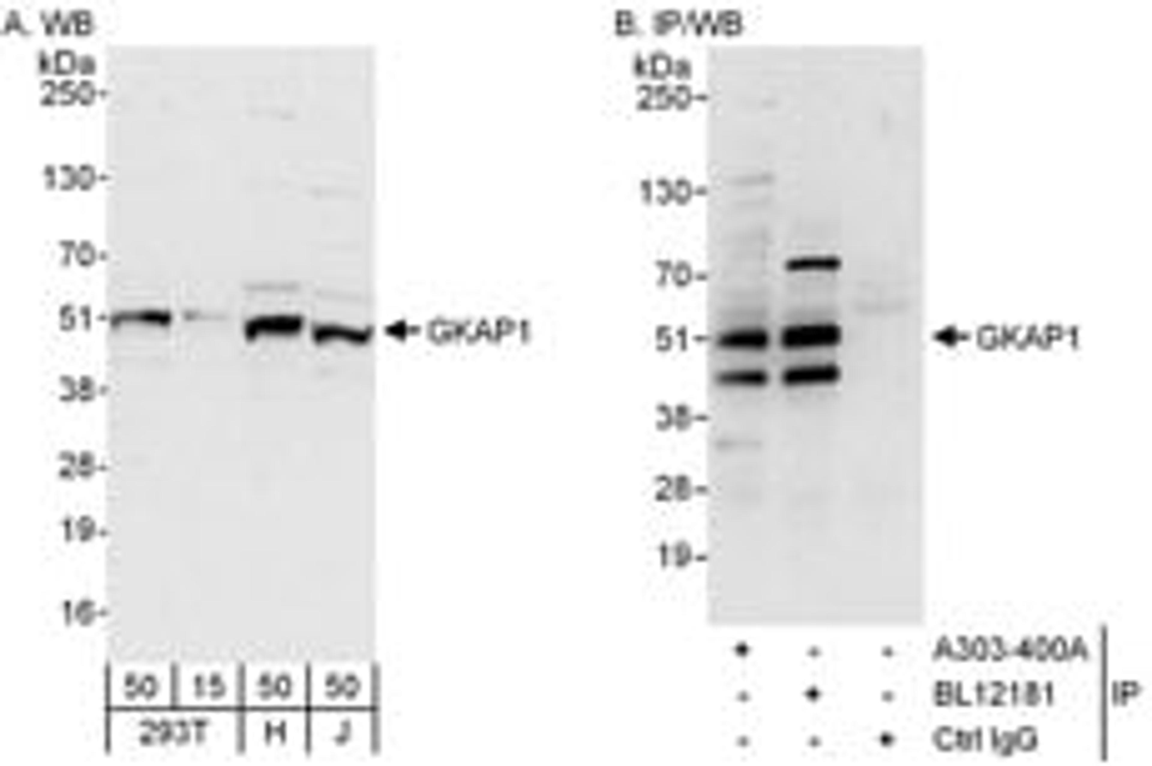 Detection of human GKAP1 by western blot and immunoprecipitation.