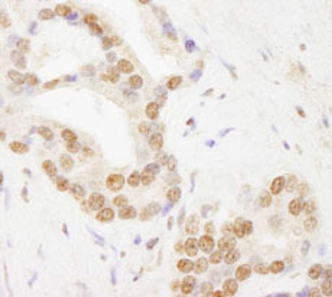 Detection of human TAF6 by immunohistochemistry.