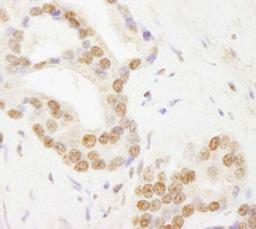 Detection of human TAF6 by immunohistochemistry.