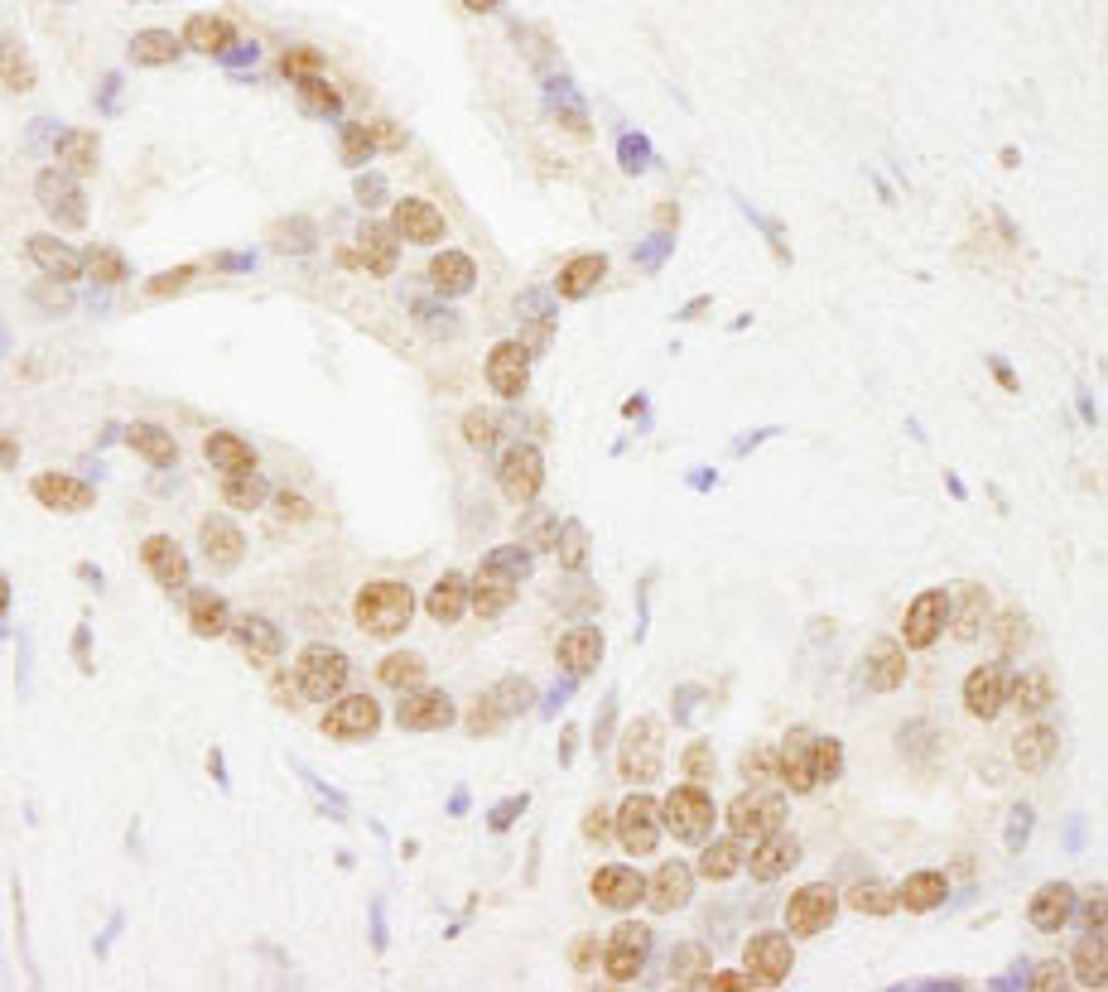 Detection of human TAF6 by immunohistochemistry.