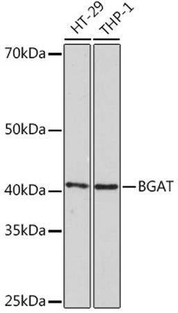 Western blot - BGAT Rabbit mAb (A5207)