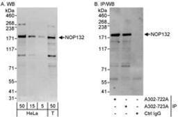 Detection of human NOP132 by western blot and immunoprecipitation.