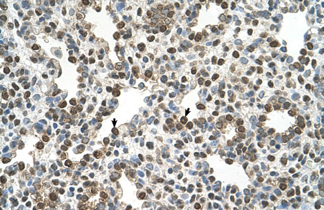 Antibody used in IHC on Human Lung.