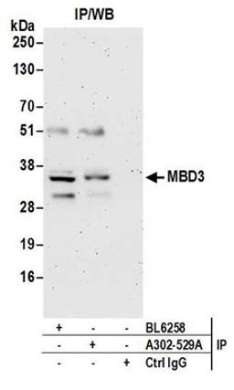 Detection of human MBD3 by western blot of immunoprecipitates.