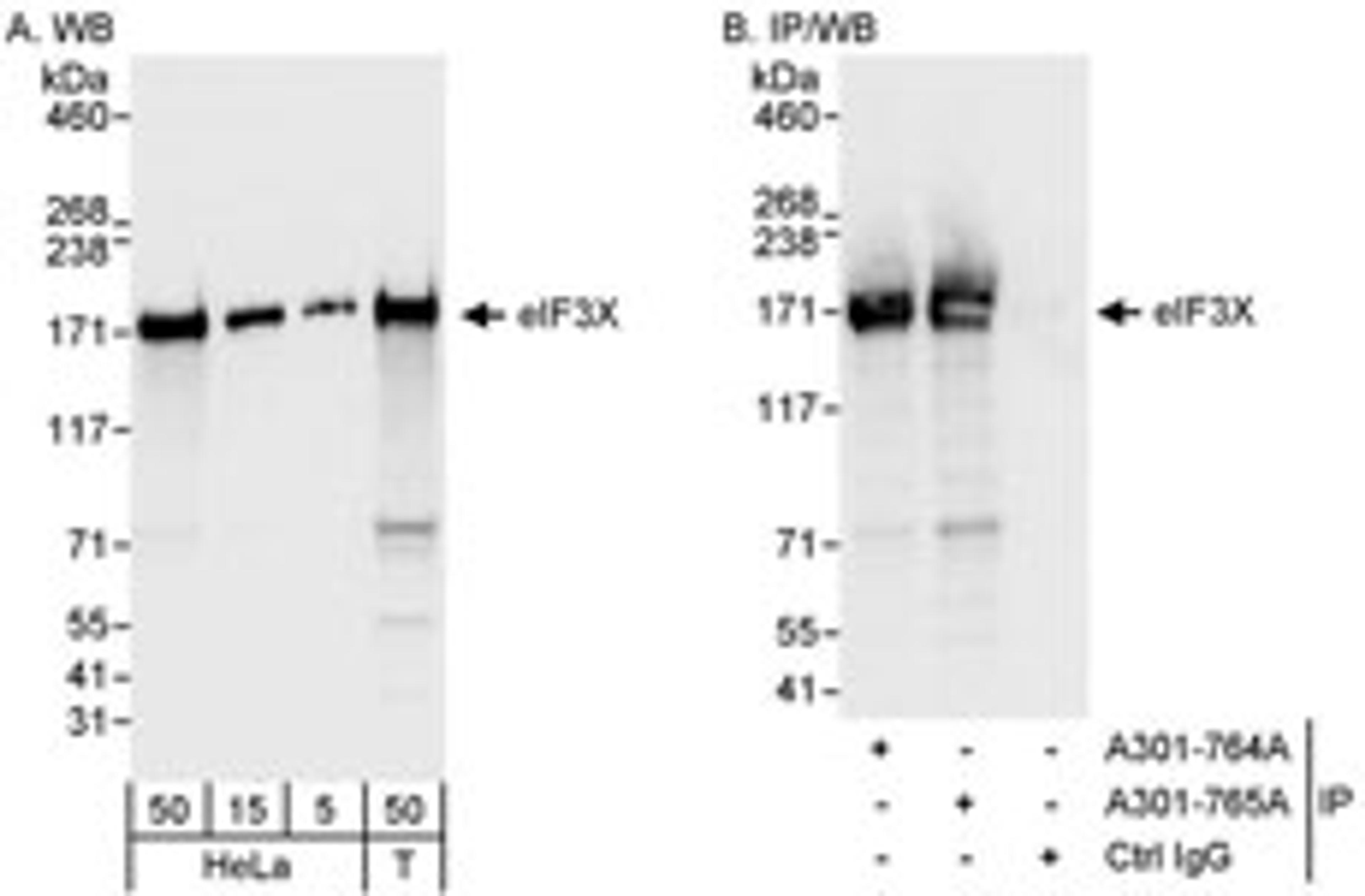 Detection of human eIF3X by western blot and immunoprecipitation.