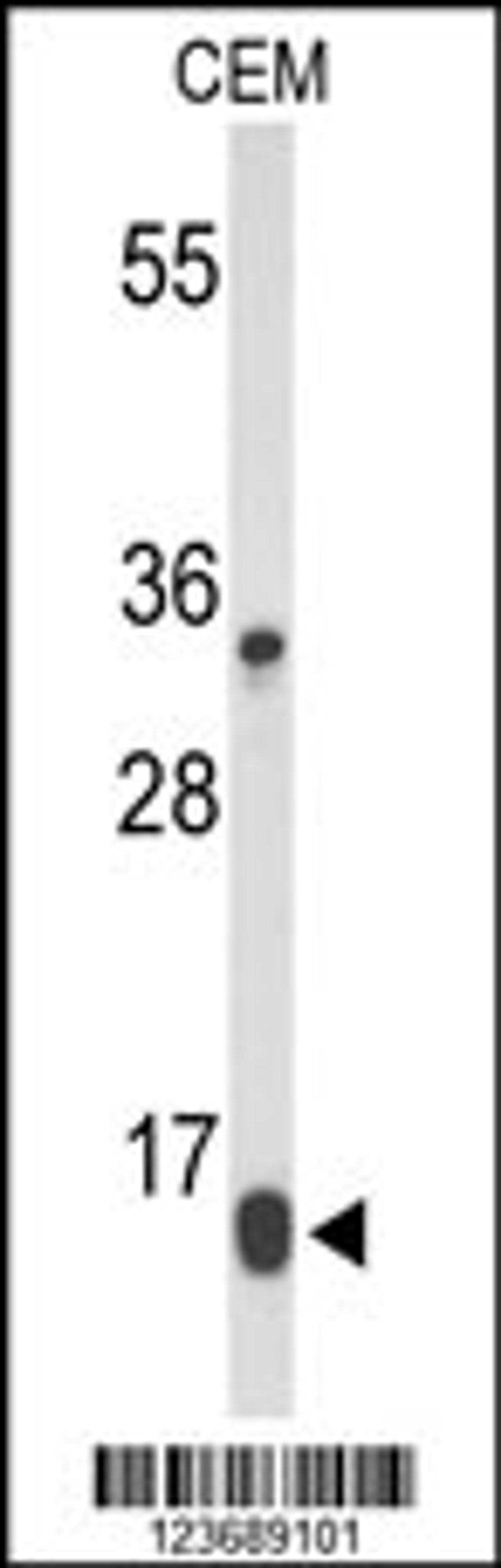 Western blot analysis of DIRAS1 Antibody in CEM cell line lysates (35ug/lane)