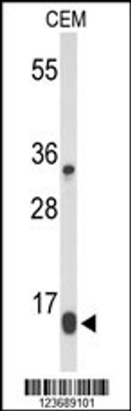 Western blot analysis of DIRAS1 Antibody in CEM cell line lysates (35ug/lane)