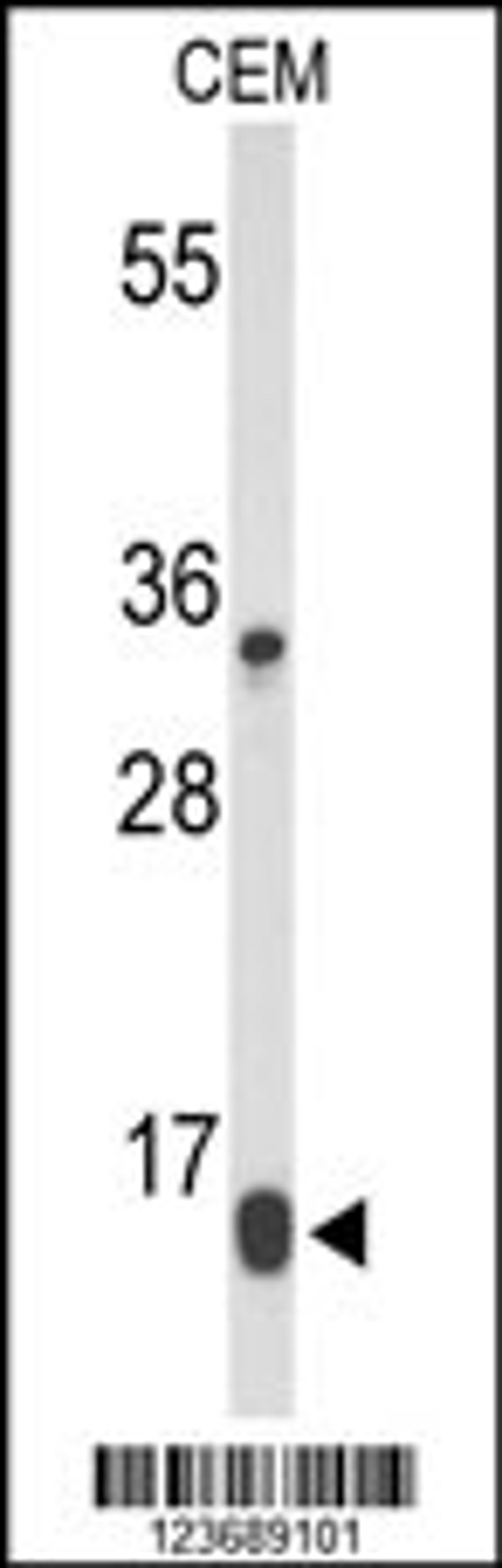 Western blot analysis of DIRAS1 Antibody in CEM cell line lysates (35ug/lane)