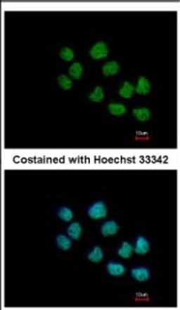 Immunocytochemistry/Immunofluorescence: SS18L1 Antibody [NBP2-20486] - Immunofluorescence analysis of paraformaldehyde-fixed A431, using antibody at 1:500 dilution.