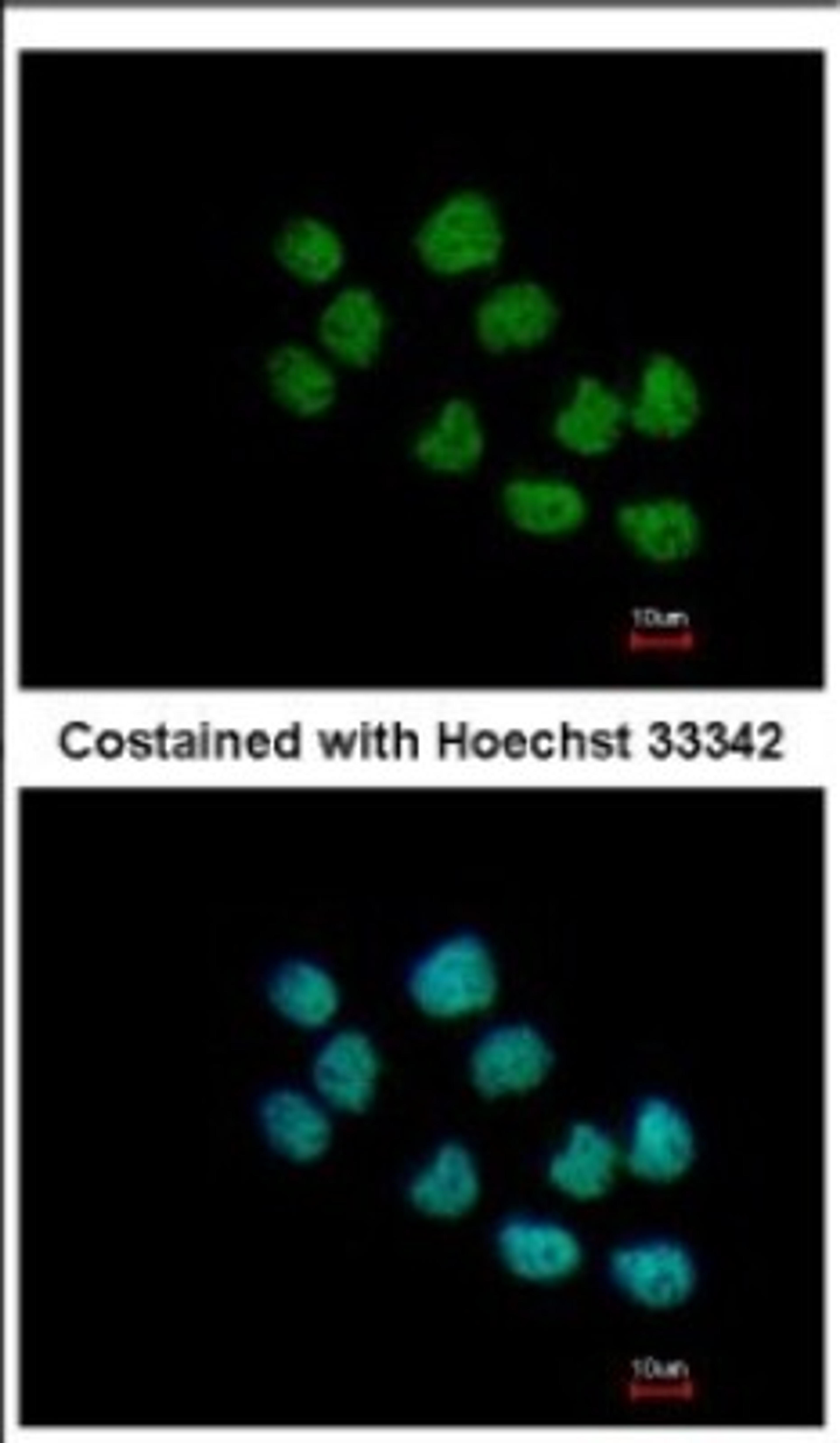 Immunocytochemistry/Immunofluorescence: SS18L1 Antibody [NBP2-20486] - Immunofluorescence analysis of paraformaldehyde-fixed A431, using antibody at 1:500 dilution.