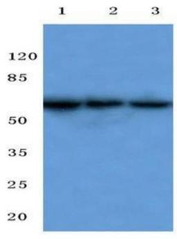 Western Blot: beta-3 Adrenergic R/ADRB3 Antibody [NBP1-00716] - Analysis of Beta 3 Adrenergic Receptor (L291) pAb at 1:500 dilution. Lane1:MCF-7 whole cell lysate. Lane2:Mouse Kidney tissue lysate   Lane3:Rat Liver tissue lysate.