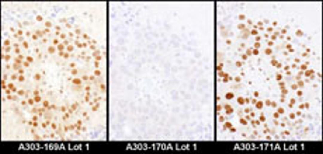 Detection of mouse HDGF by immunohistochemistry.