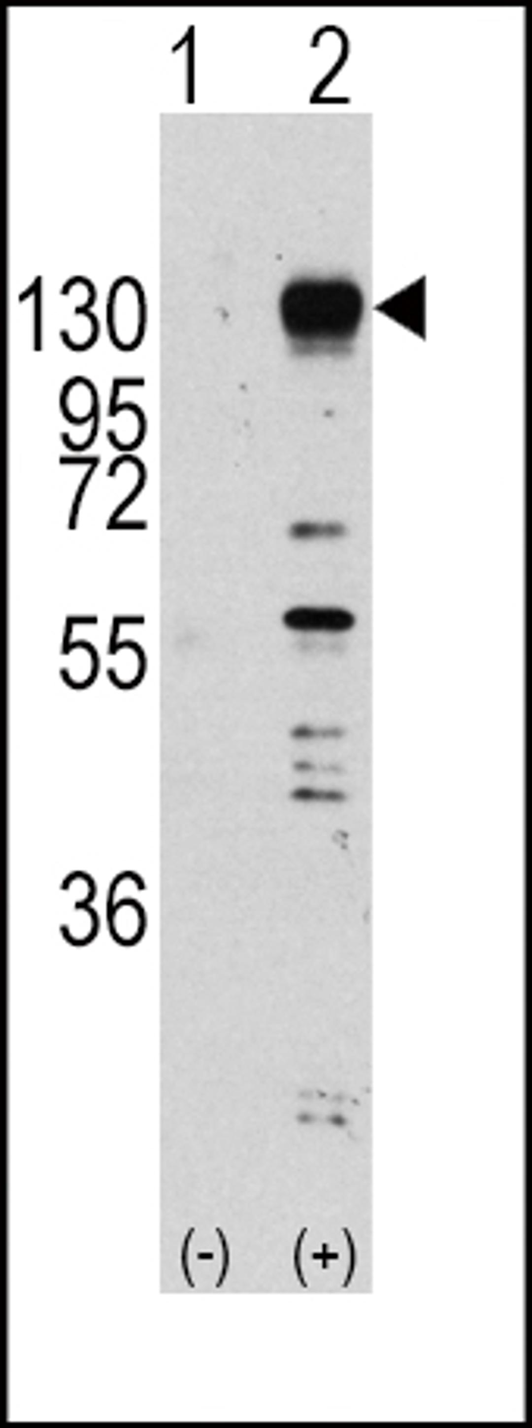 Western blot analysis of FGFR1 using rabbit polyclonal FGFR1 Antibody (Y653) using 293 cell lysates (2 ug/lane) either nontransfected (Lane 1) or transiently transfected with the FGFR1 gene (Lane 2).