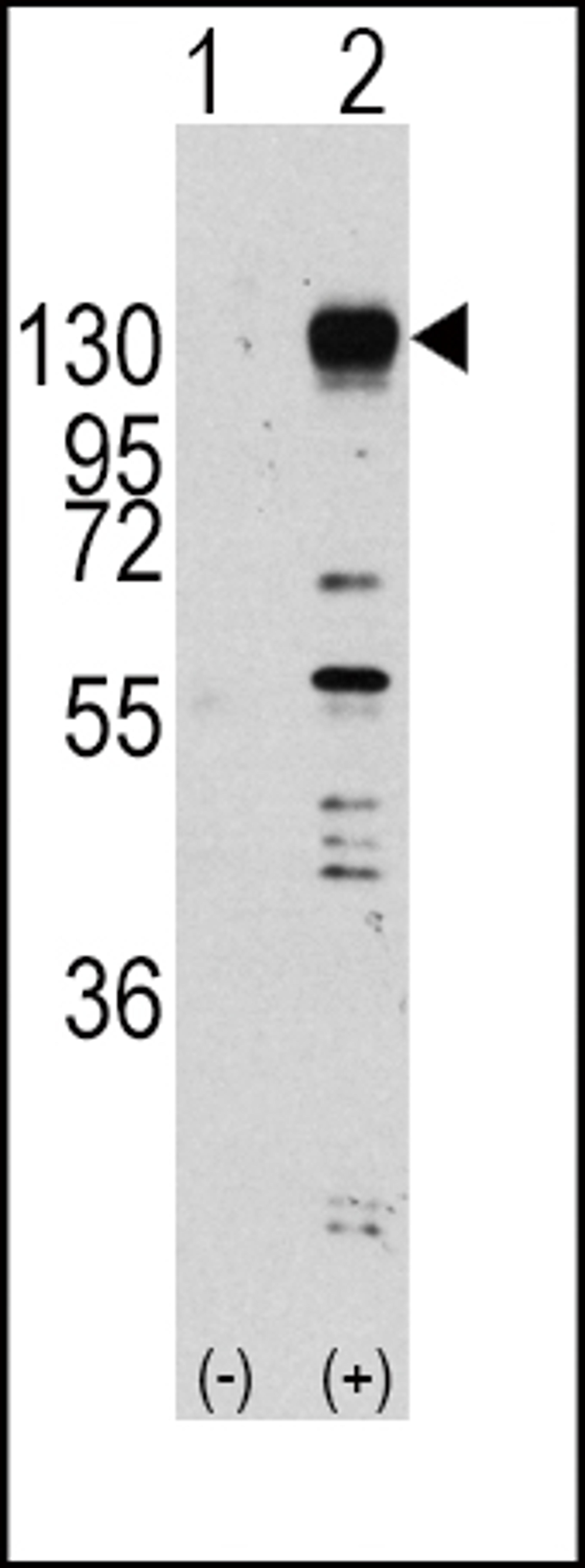 Western blot analysis of FGFR1 using rabbit polyclonal FGFR1 Antibody (Y653) using 293 cell lysates (2 ug/lane) either nontransfected (Lane 1) or transiently transfected with the FGFR1 gene (Lane 2).