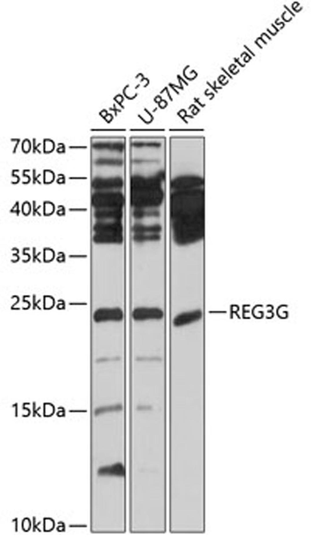 Western blot - REG3G antibody (A2146)