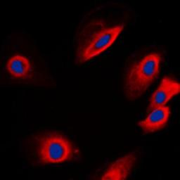 Immunofluorescense analysis of SKNSH cells using PTP1B antibody