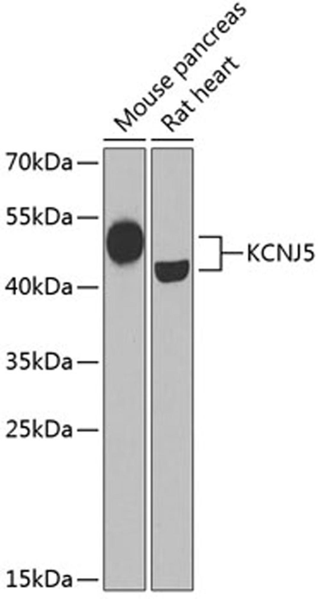 Western blot - KCNJ5 Antibody (A6232)