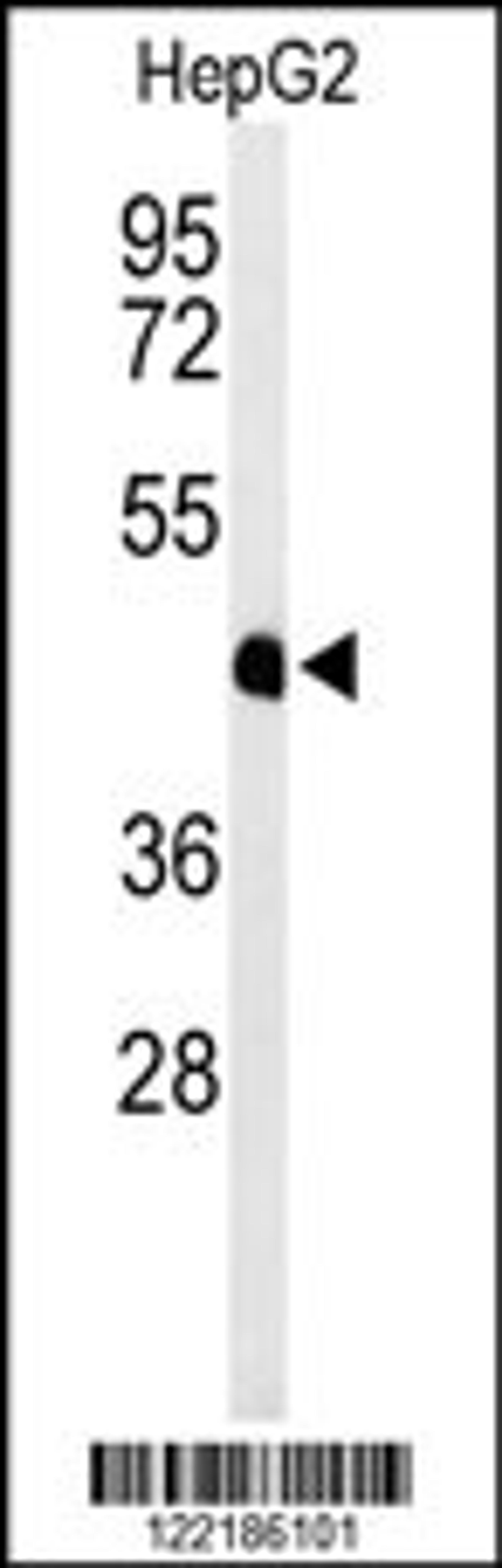 Western blot analysis of HFE2 Antibody in HepG2 cell line lysates (35ug/lane)