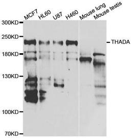 Western blot analysis of extracts of various cell lines using THADA antibody