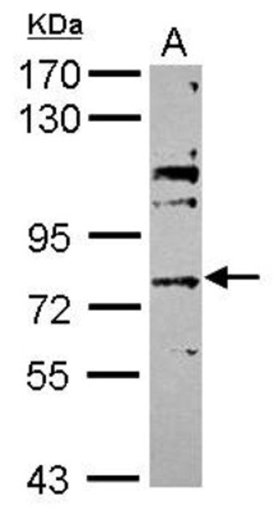 Western Blot: ABCG4 Antibody [NBP2-15229] - Sample (30 ug of whole cell lysate) A: MCF-7 7.5% SDS PAGE; antibody diluted at 1:5000.