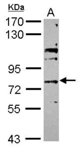 Western Blot: ABCG4 Antibody [NBP2-15229] - Sample (30 ug of whole cell lysate) A: MCF-7 7.5% SDS PAGE; antibody diluted at 1:5000.