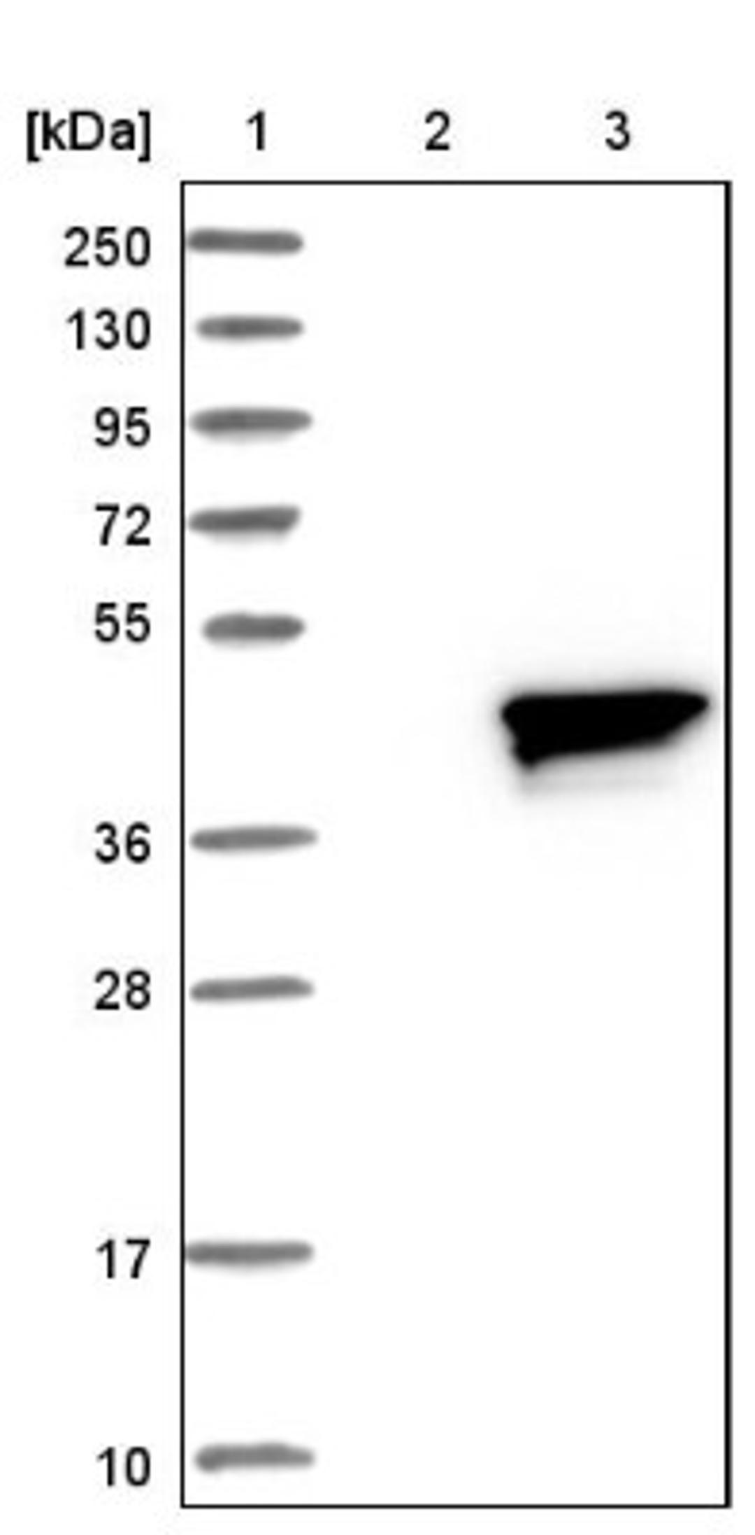 Western Blot: RRAGB Antibody [NBP1-85801] - Lane 1: Marker [kDa] 250, 130, 95, 72, 55, 36, 28, 17, 10<br/>Lane 2: Negative control (vector only transfected HEK293T lysate)<br/>Lane 3: Over-expression lysate (Co-expressed with a C-terminal myc-DDK tag (~3.1 kDa) in mammalian HEK293T cells, LY416897)