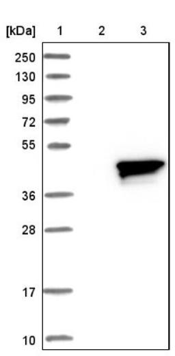 Western Blot: RRAGB Antibody [NBP1-85801] - Lane 1: Marker [kDa] 250, 130, 95, 72, 55, 36, 28, 17, 10<br/>Lane 2: Negative control (vector only transfected HEK293T lysate)<br/>Lane 3: Over-expression lysate (Co-expressed with a C-terminal myc-DDK tag (~3.1 kDa) in mammalian HEK293T cells, LY416897)