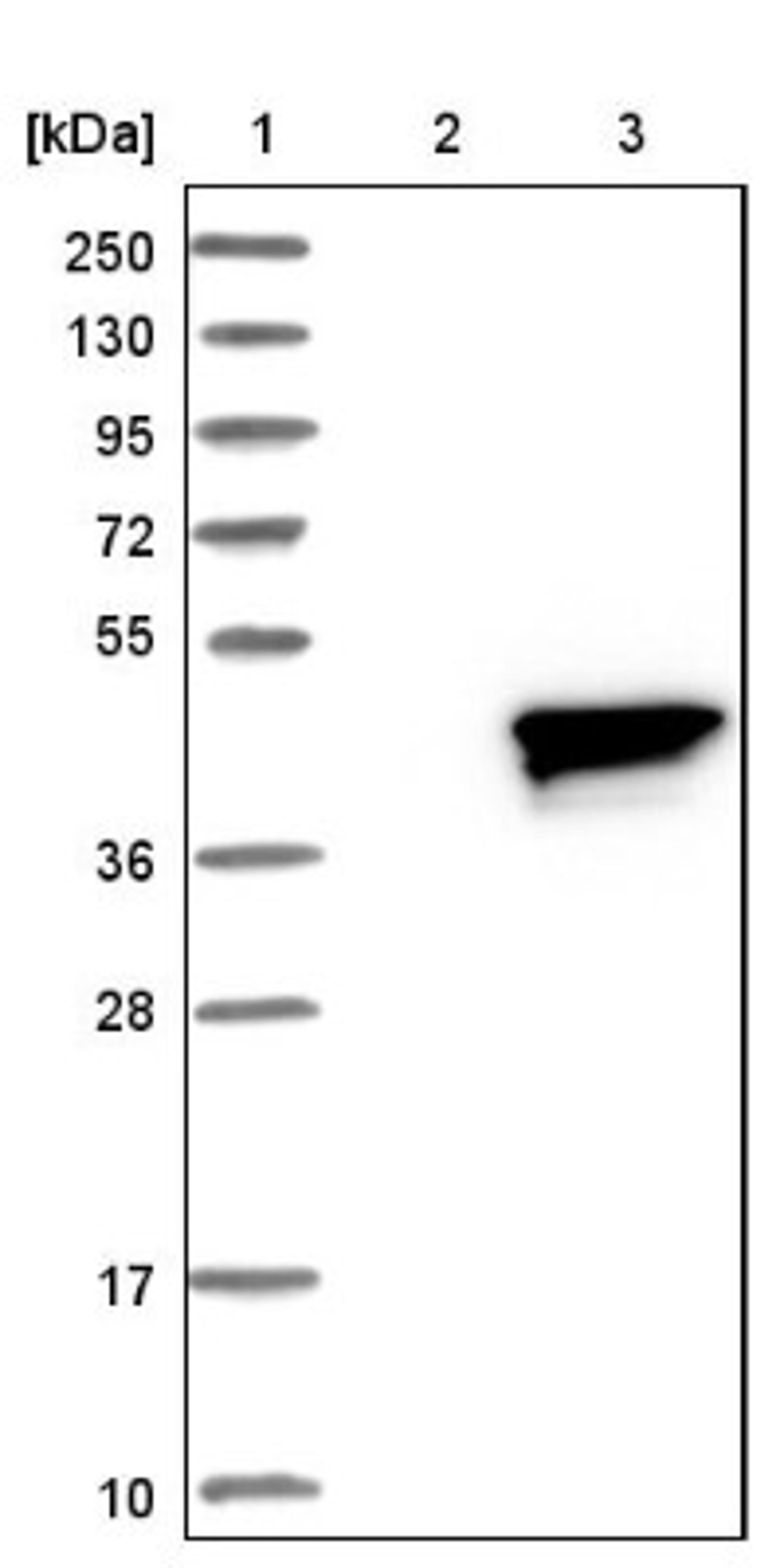 Western Blot: RRAGB Antibody [NBP1-85801] - Lane 1: Marker [kDa] 250, 130, 95, 72, 55, 36, 28, 17, 10<br/>Lane 2: Negative control (vector only transfected HEK293T lysate)<br/>Lane 3: Over-expression lysate (Co-expressed with a C-terminal myc-DDK tag (~3.1 kDa) in mammalian HEK293T cells, LY416897)