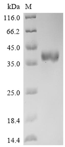 (Tris-Glycine gel) Discontinuous SDS-PAGE (reduced) with 5% enrichment gel and 15% separation gel.