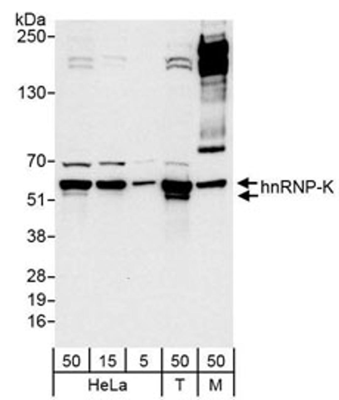 Detection of human and mouse hnRNP-K by western blot.