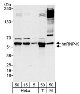 Detection of human and mouse hnRNP-K by western blot.