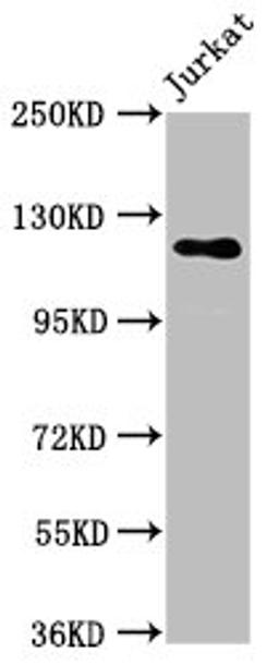 Western Blot. Positive WB detected in: Jurkat whole cell lysate. All lanes: SREBF1 antibody at 5.7µg/ml. Secondary. Goat polyclonal to rabbit IgG at 1/50000 dilution. Predicted band size: 122, 114, 112, 125, 49, 46 kDa. Observed band size: 122 kDa