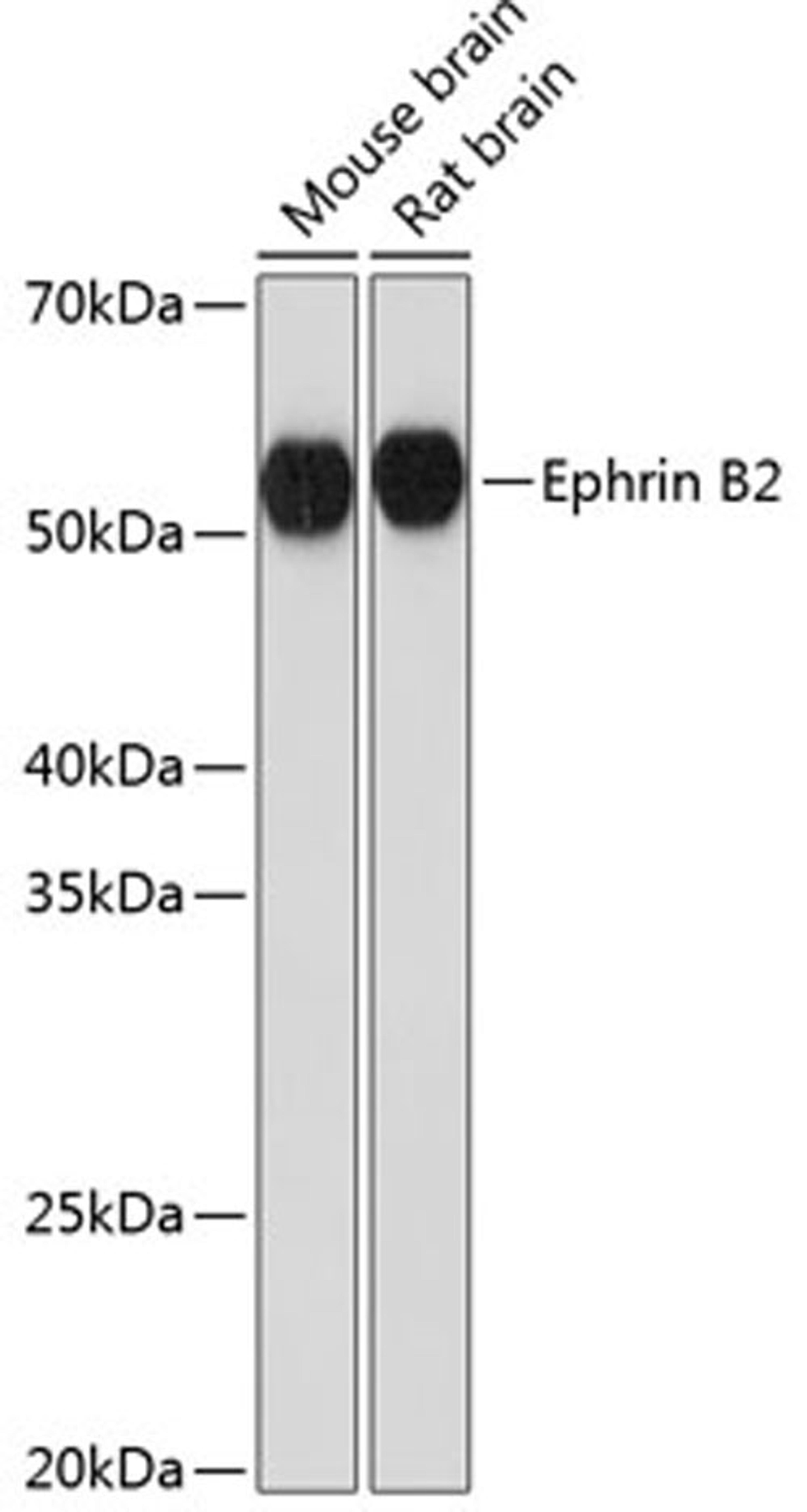 Western blot - Ephrin B2  Rabbit mAb (A11349)