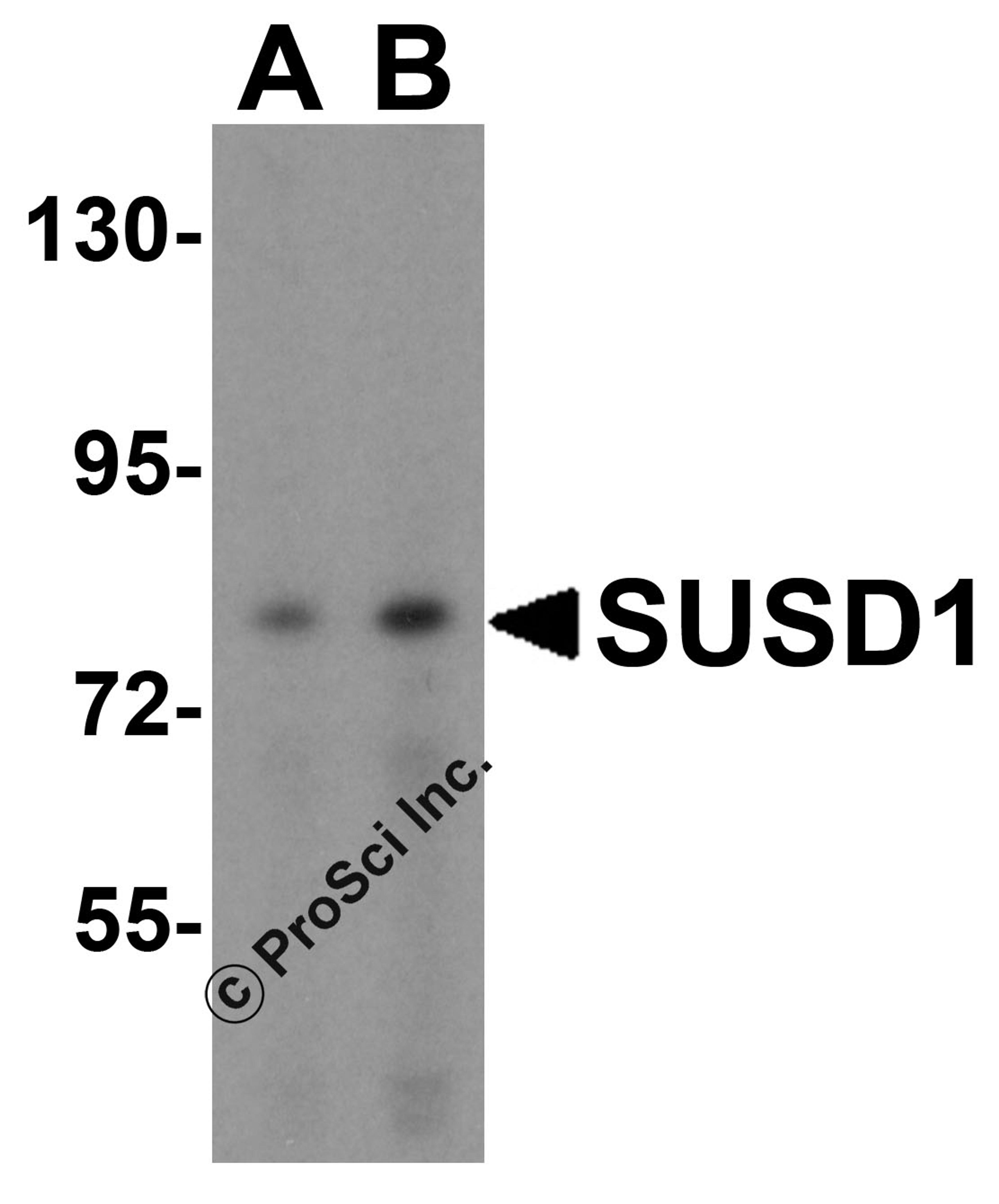 Western blot analysis of SUSD1 in 293 cell lysate with SUSD1 antibody at (A) 0.5 and (B) 1 &#956;g/mL.