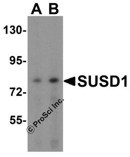 Western blot analysis of SUSD1 in 293 cell lysate with SUSD1 antibody at (A) 0.5 and (B) 1 μg/mL.