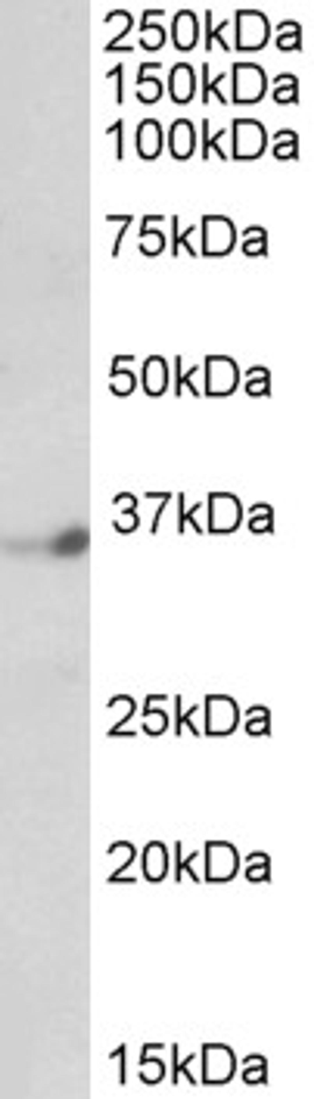 45-954 (1ug/ml) staining of Human Brain (Cerebellum) lysate (35ug protein in RIPA buffer). Primary incubation was 1 hour. Detected by chemiluminescence.