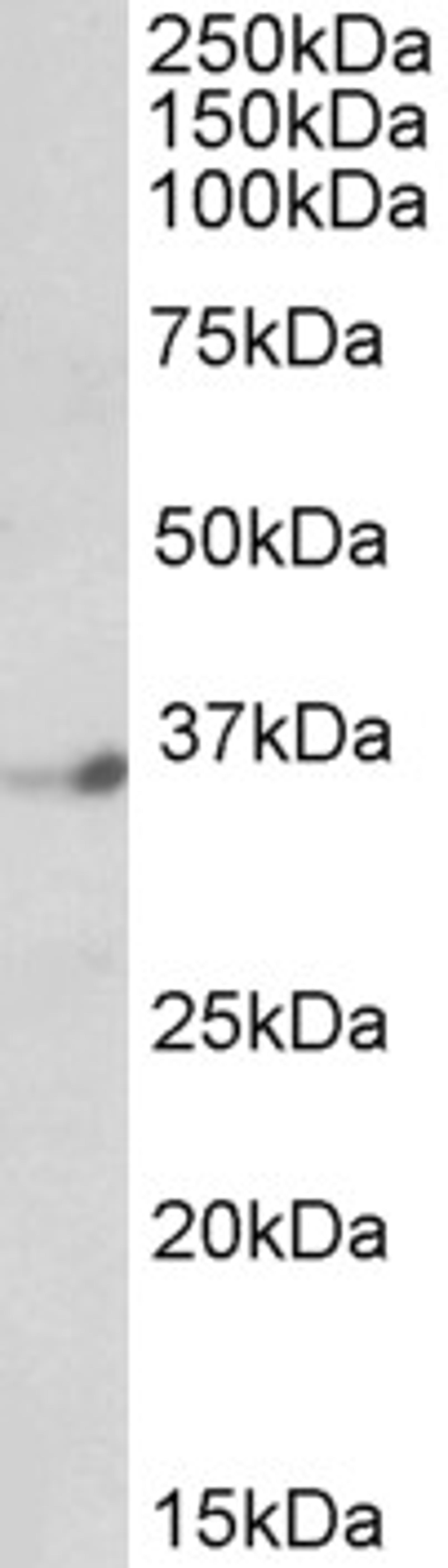 45-954 (1ug/ml) staining of Human Brain (Cerebellum) lysate (35ug protein in RIPA buffer). Primary incubation was 1 hour. Detected by chemiluminescence.