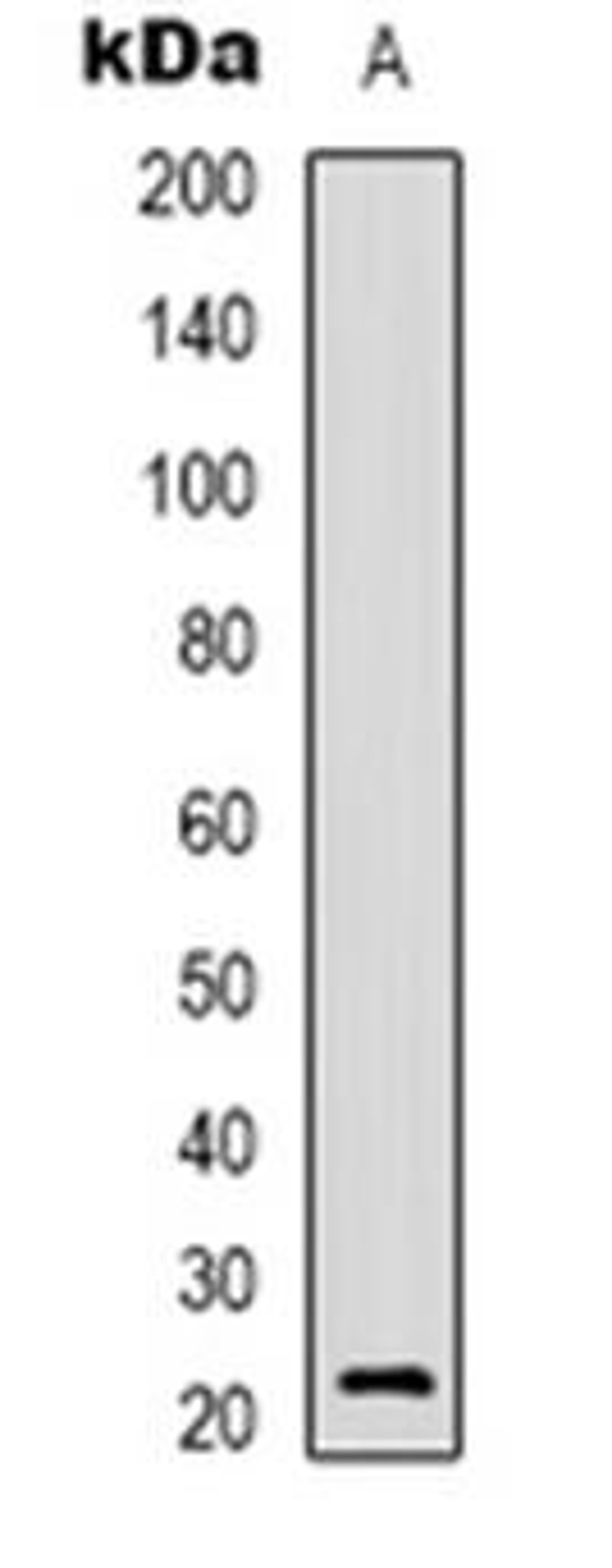 Western blot analysis of BCA3 expression in A549 (Lane 1) whole cell lysates using AKIP1 antibody