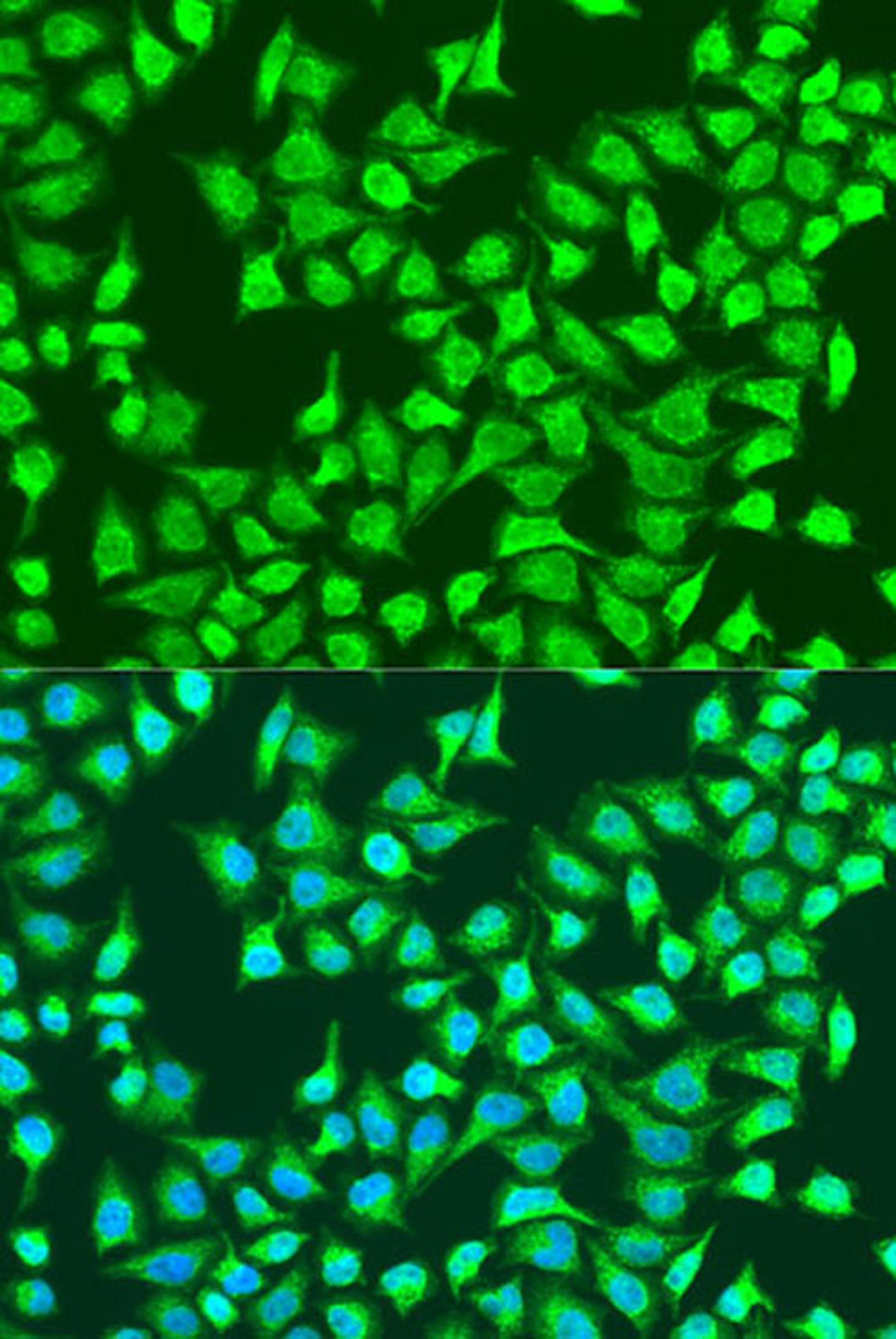 Immunofluorescence - SIRT4 antibody (A15800)